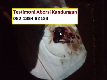 Obat Penggugur Kandungan ® WA.082133482133 Obat Aborsi Murah