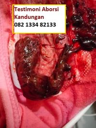 Obat Penggugur Kandungan ® WA.082133482133 Obat Aborsi Magelang