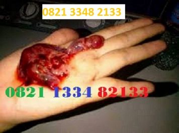 Obat Penggugur Kandungan ® WA.082133482133 Obat Aborsi Palopo