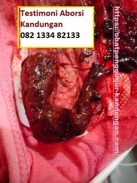 Obat Penggugur Kandungan ® WA.082133482133 Obat Aborsi Palu