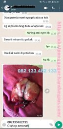 Obat Penggugur Kandungan ® WA.082133482133 Obat Aborsi Maluku