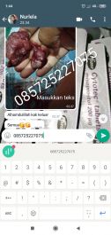 Obat Aborsi Rembang Wa 085725227075 Jual Obat Aborsi Cytotec Asli Tuntas Dalam 3 jam