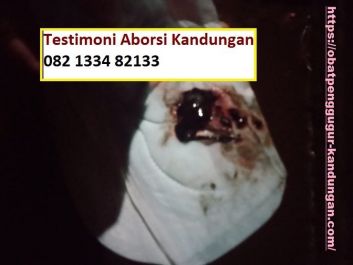 Obat Penggugur Kandungan ® WA.082133482133 Obat Aborsi Bengkulu